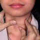 Тироксин свободный (T4): важный гормон для здоровья щитовидной железы